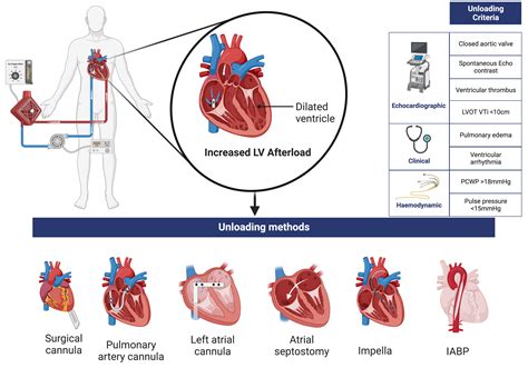 lv vent ecmo|Lv unloading in va ecmo.